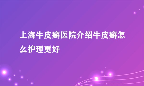 上海牛皮癣医院介绍牛皮癣怎么护理更好