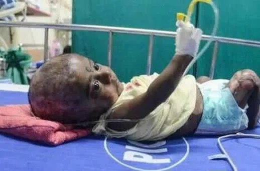 三月男婴身体无故自燃医生无解（图）