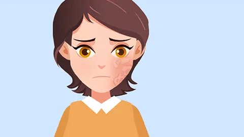 过敏性紫癜会遗传吗