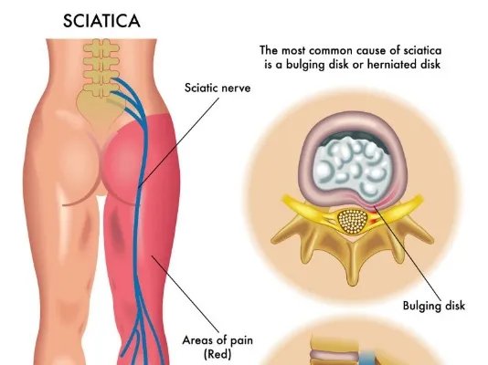 神经外科看什么病