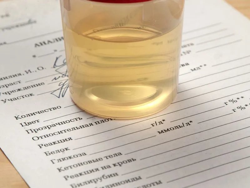 嘌呤代谢异常的后果