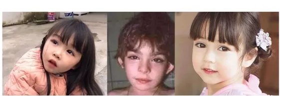 长得太漂亮也是病？歌舞伎面谱综合征，一种美得像洋娃娃的遗传病