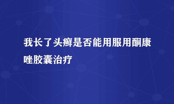 我长了头癣是否能用服用酮康唑胶囊治疗