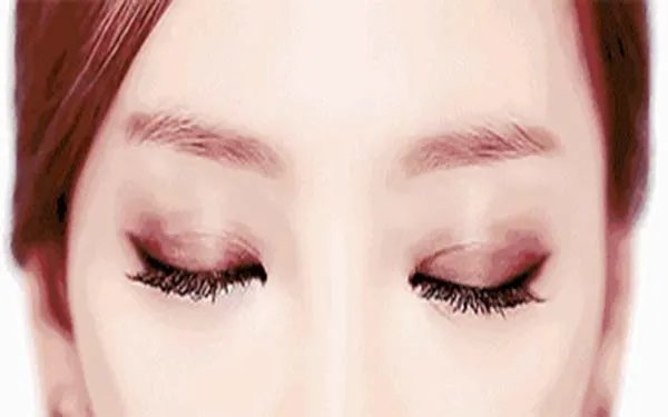 去眼袋手术需要多少钱