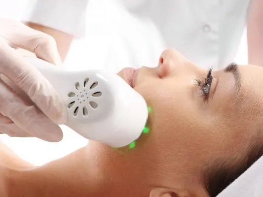 激光治疗红血丝效果好吗