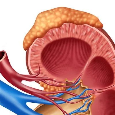 肾部囊肿是怎么回事?