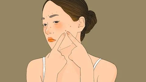 治痤疮的方法怎么最有效