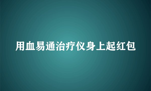 用血易通治疗仪身上起红包