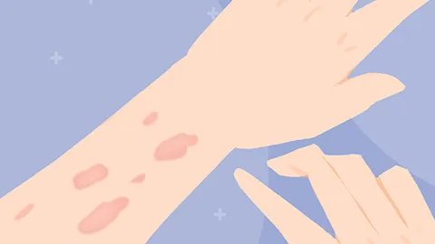 皮肤过敏有什么症状表现