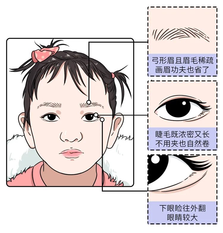 长得太漂亮也是病？歌舞伎面谱综合征，一种美得像洋娃娃的遗传病