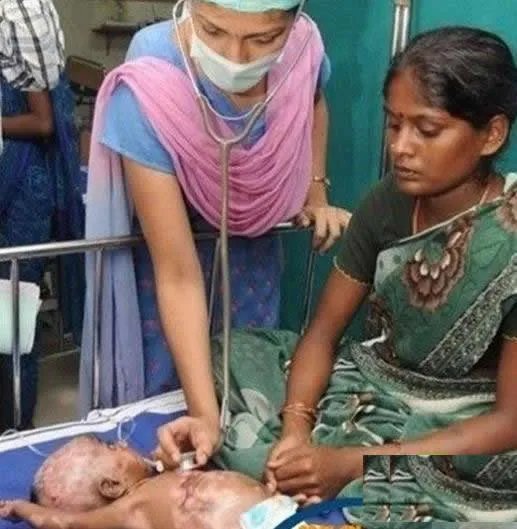 三月男婴身体无故自燃医生无解（图）