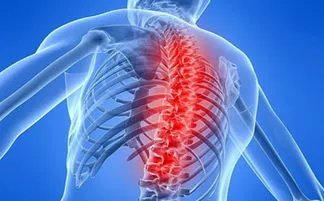 李宇春患了强直性脊柱炎，被称为不死的癌症，这种病真的很可怕吗？