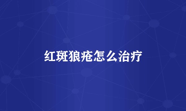 红斑狼疮怎么治疗
