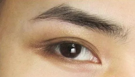 双眼皮手术价格表