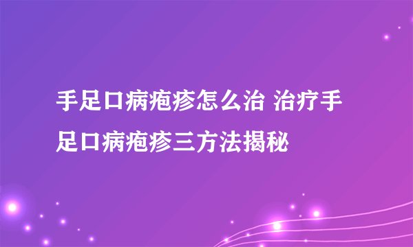手足口病疱疹怎么治 治疗手足口病疱疹三方法揭秘