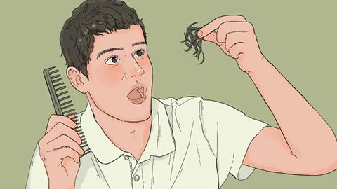 男人秃头原因有什么