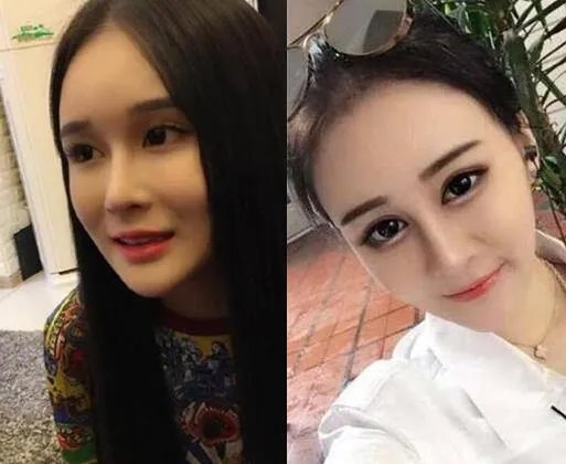 赵本山女儿斥喷子太闲 被质疑整成网红脸