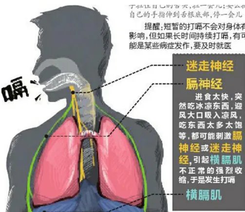 世界上打嗝时间最长的人,美国农夫打嗝长达68年（每天打嗝24000次）