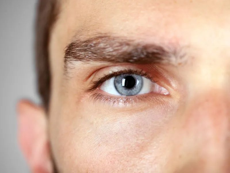 去眼袋手术后遗症