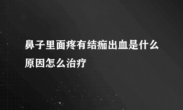 鼻子里面疼有结痂出血是什么原因怎么治疗