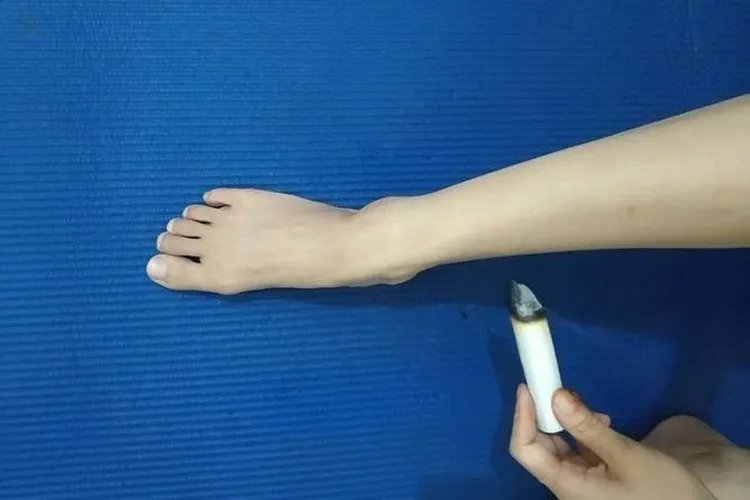 艾灸三阴焦位置图和作用