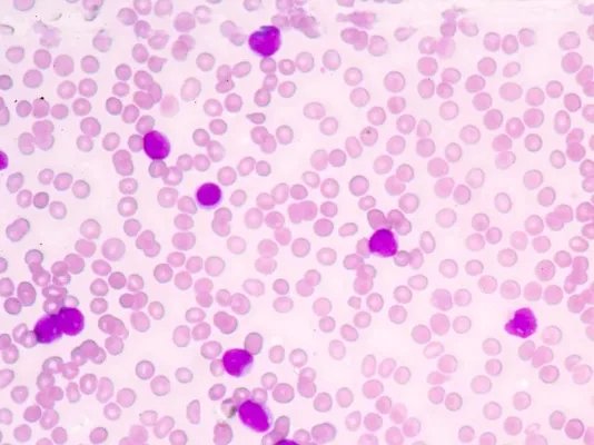 头孢他啶的作用与功效