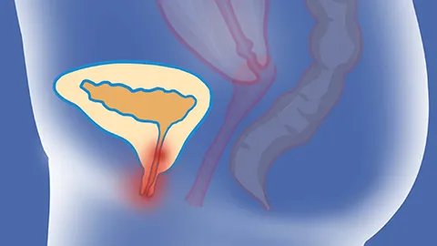 解热镇痛抗炎药有哪些