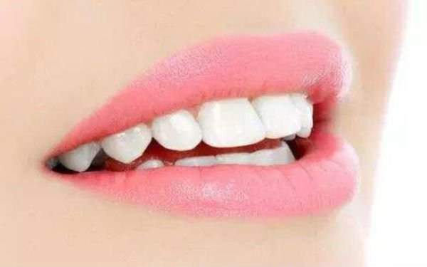 牙齿美白