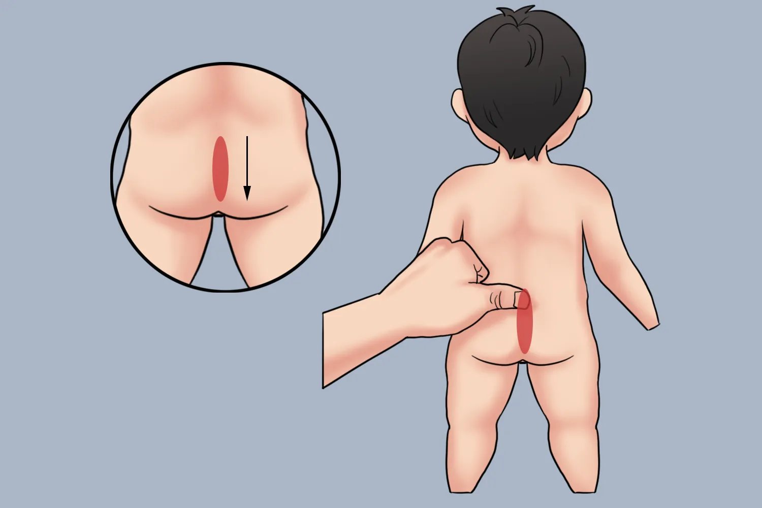 下推七节骨推拿示意图