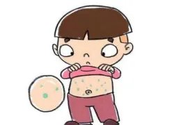 过敏性紫癜如何治疗