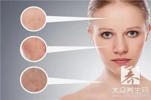 脸颊长痤疮怎么调理  