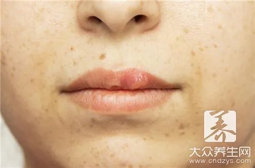 极度干燥怎么样？