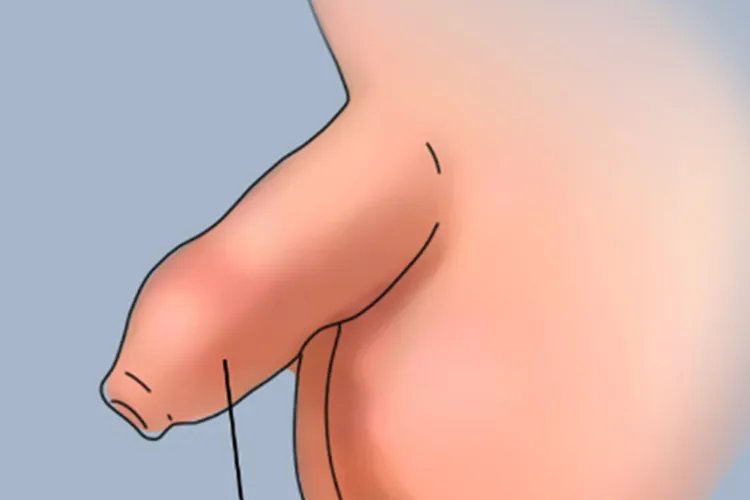 10岁小孩阴茎图