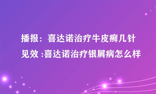 播报：喜达诺治疗牛皮癣几针见效 :喜达诺治疗银屑病怎么样