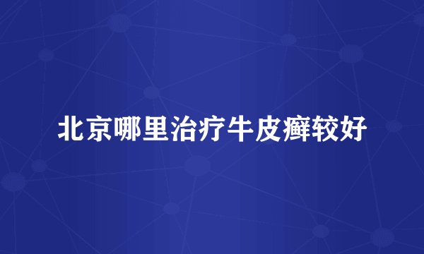 北京哪里治疗牛皮癣较好