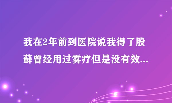 我在2年前到医院说我得了股藓曾经用过雾疗但是没有效果现在我的下身经常奇痒我现在就是买了派瑞松涂涂了就..