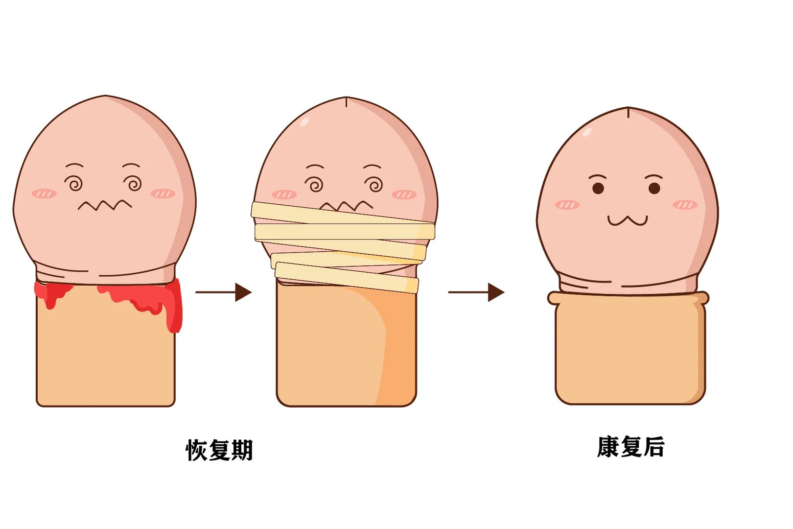 男孩子做完包皮手术后的图片