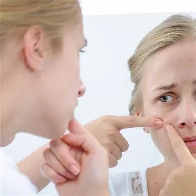 快速去痘印方法