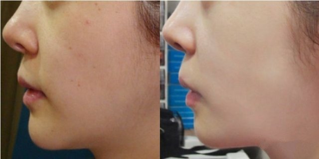 黑脸娃娃美容效果很不错吗