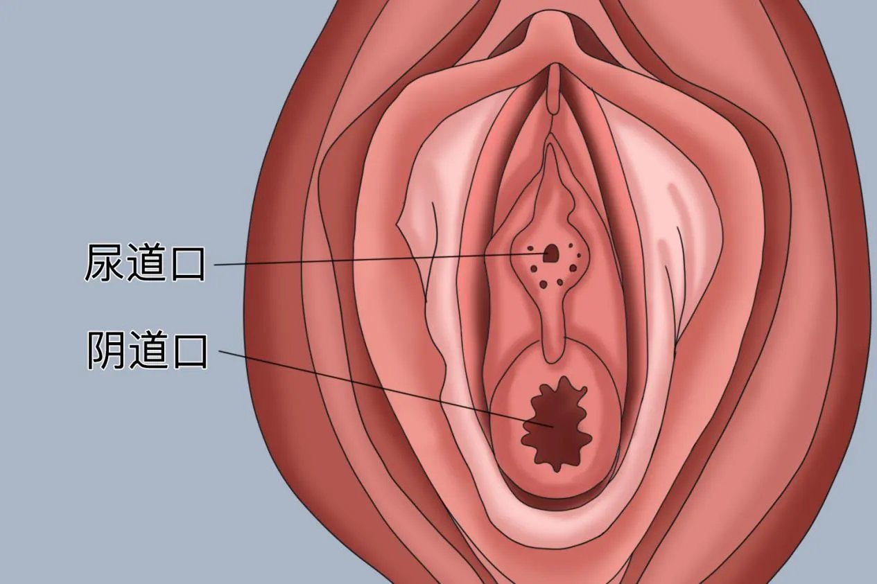 女宝宝尿道口图片