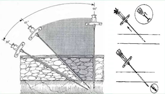 股动脉穿刺技巧图解