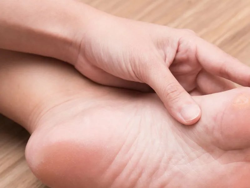 脚底脱皮怎么办