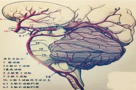 小脑后下动脉分段解剖图