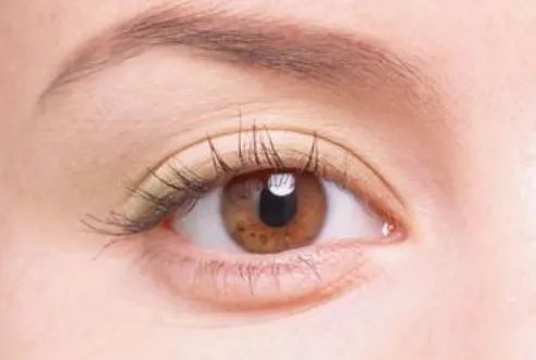 切开双眼皮整形北京哪家医院好？