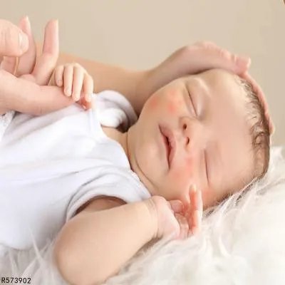 婴儿湿疹用什么药治疗好  介绍治婴儿湿疹的内外药物