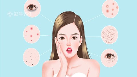 额头长痘痘怎么办