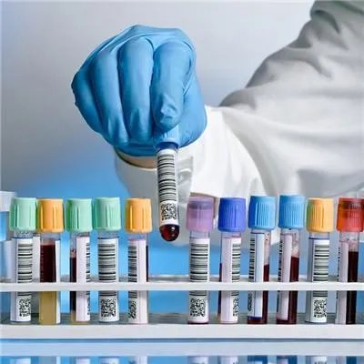 白化病是什么病