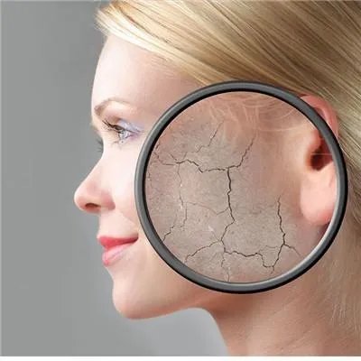 祛斑的有效方法