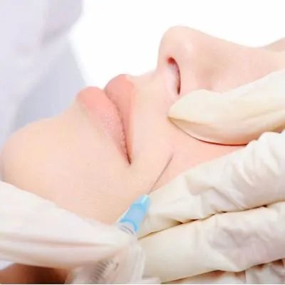 去痘印的方法有哪些