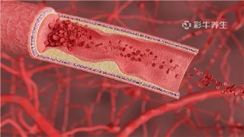 门静脉内径多少正常